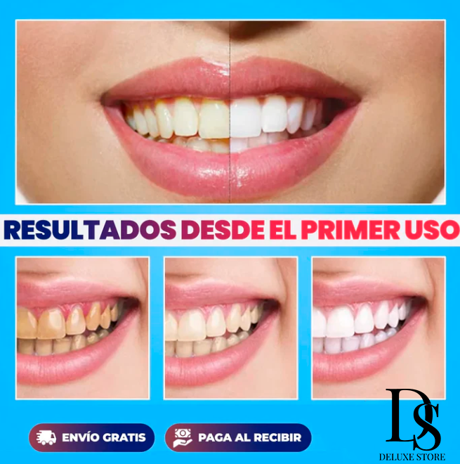 Kit Blanqueador Dental Pro de Rayos UV (Blanqueamiento en Casa)