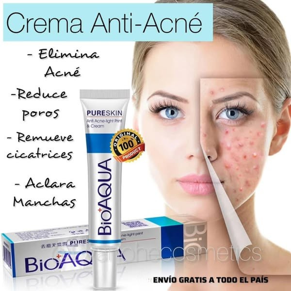 Crema Anti Acné "Bioaqua"