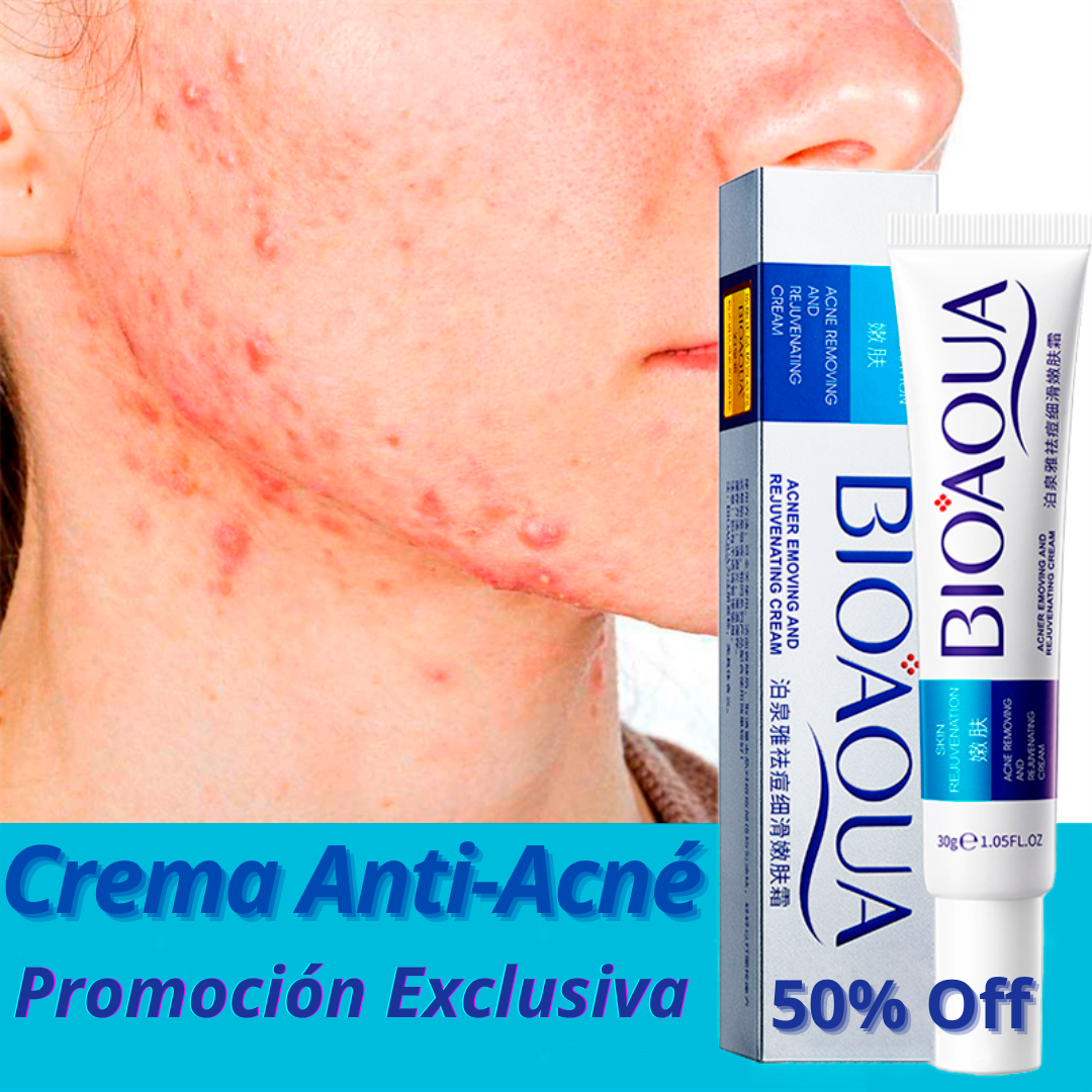 Crema Anti Acné "Bioaqua"