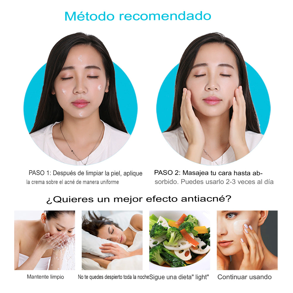 Crema Anti Acné "Bioaqua"