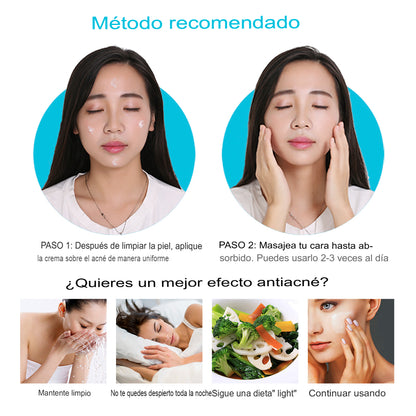 Crema Anti Acné "Bioaqua"