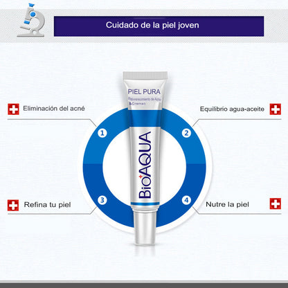 Crema Anti Acné "Bioaqua"